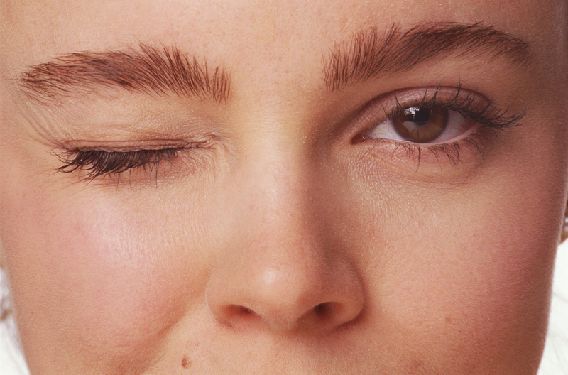 Tratamientos de fisioterapia especiales. Reeducación postura